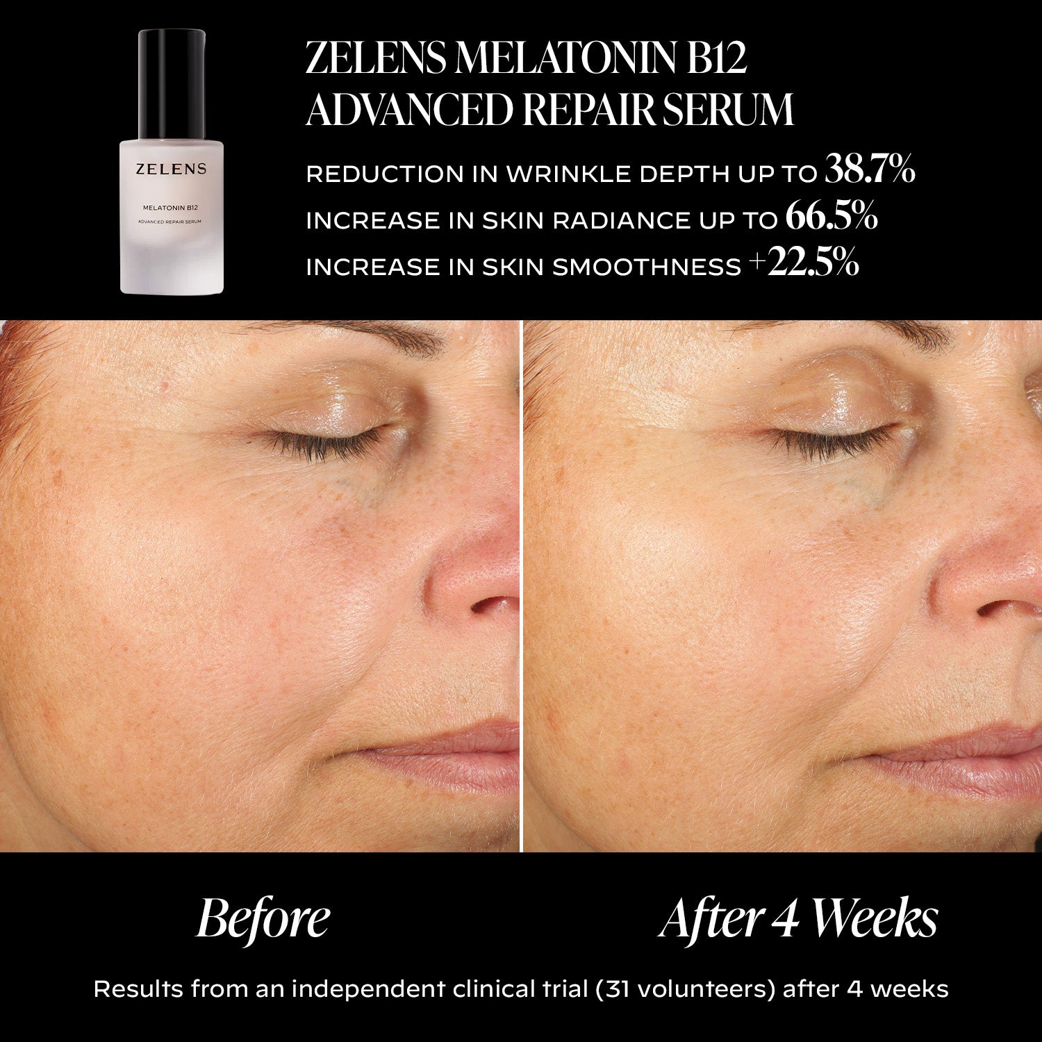 Melatonin B12 Advanced Repair Serum | Zelens